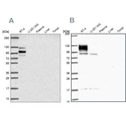Western blot analysis using Anti-EPB41L1 antibody HPA056817 (A) shows similar pattern to independent antibody HPA054104 (B).