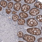 Immunohistochemical staining of human colon shows moderate to strong membranous positivity in glandular cells.