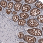 Immunohistochemical staining of human colon shows moderate to strong membranous positivity in glandular cells.