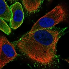 Immunofluorescent staining of human cell line A549 shows localization to plasma membrane.