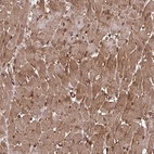 Anti-TRIM52 Antibody