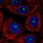 Immunofluorescent staining of human cell line MCF7 shows localization to nucleoli.