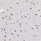 Anti-HNRNPDL Antibody