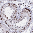 Immunohistochemical staining of human Testis shows strong nuclear positivity in cells in seminiferous ducts.