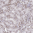 Anti-HNRNPDL Antibody