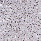 Anti-HNRNPDL Antibody