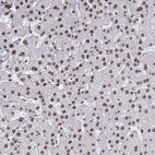 Immunohistochemical staining of human Liver shows strong nuclear positivity in hepatocytes.