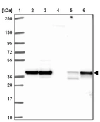 Lane 1: Marker [kDa] 250, 130, 95, 72, 55, 36, 28, 17, 10_br/_Lane 2: Human cell line RT-4_br/_Lane 3: Human cell line U-251 MG_br/_Lane 4: Human plasma_br/_Lane 5: Human Liver tissue_br/_Lane 6: Human Tonsil tissue