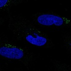 Anti-MGAT2 Antibody