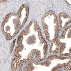 Immunohistochemical staining of human prostate shows strong membranous positivity in glandular cells.