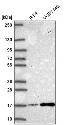 Anti-NEK6 Antibody