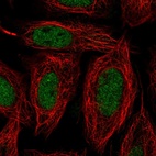 Anti-SNAI1 Antibody