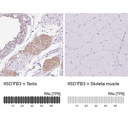 Anti-HSD17B3 Antibody