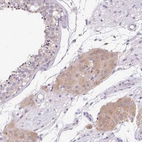Immunohistochemical staining of human testis shows moderate cytoplasmic positivity in Leydig cells.