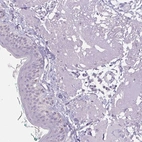 Immunohistochemical staining of human skin shows negative cytoplasmic positivity in keratinocytes as expected.
