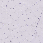 Immunohistochemical staining of human skeletal muscle shows negative cytoplasmic positivity in myocytes as expected.