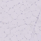 Immunohistochemical staining of human skeletal muscle shows negative cytoplasmic positivity in myocytes as expected.