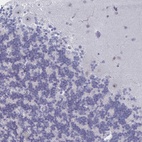 Anti-NR1H2 Antibody