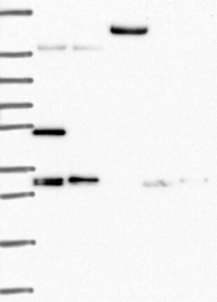 Anti-TACC1 Antibody