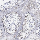 Anti-PSKH2 Antibody
