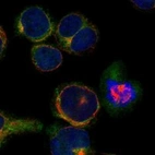 Immunofluorescent staining of human cell line HEL shows localization to cytosol.