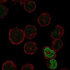 Anti-PSKH2 Antibody