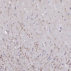 Anti-ARPP19 Antibody