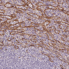Immunohistochemical staining of human spleen shows moderate membranous positivity in cells in red pulp.