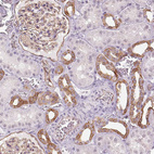 Anti-AIF1L Antibody