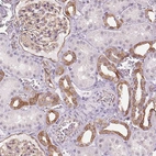 Immunohistochemical staining of human kidney shows moderate membranous positivity in cells in distal tubules.