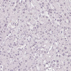 Immunohistochemical staining of human liver shows no positivity in hepatocytes as expected.