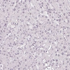 Immunohistochemical staining of human liver shows no positivity in hepatocytes as expected.