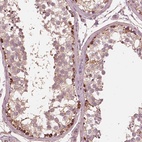 Anti-STK33 Antibody