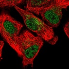 Anti-SFXN5 Antibody