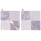 Immunohistochemical staining of human endometrium, liver, skeletal muscle and tonsil using Anti-DSG3 antibody HPA056863 (A) shows similar protein distribution across tissues to independent antibody HPA046864 (B).