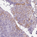 Immunohistochemical staining of human tonsil shows moderate membranous positivity in squamous epithelial cells.