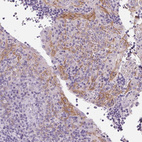 Anti-DSG3 Antibody