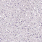 Anti-DSG3 Antibody