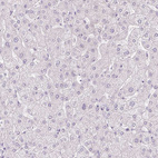 Immunohistochemical staining of human liver shows no positivity in hepatocytes as expected.