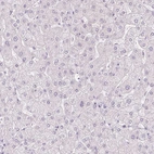 Immunohistochemical staining of human liver shows no positivity in hepatocytes as expected.