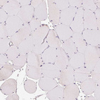 Immunohistochemical staining of human skeletal muscle shows no positivity in myocytes as expected.