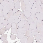 Immunohistochemical staining of human skeletal muscle shows no positivity in myocytes as expected.
