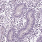 Immunohistochemical staining of human endometrium shows no positivity in glandular cells as expected.