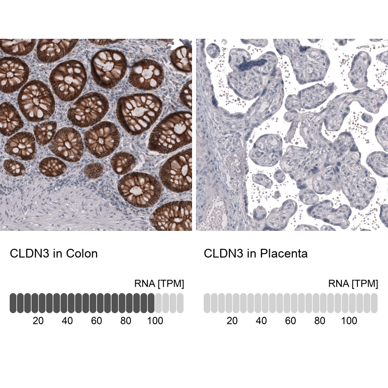 Anti-CLDN3 Antibody