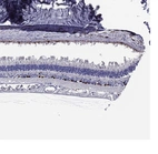 Immunohistochemical staining of human eye, retina shows strong nuclear positivity in the inner nuclear layer.