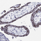 Immunohistochemical staining of human placenta shows strong nuclear positivity in trophoblastic cells.