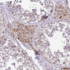 Anti-PYCR2 Antibody