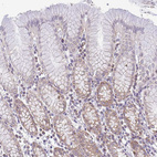 Immunohistochemical staining of human stomach shows weak to moderate granular cytoplasmic positivity in glandular cells.