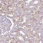 Immunohistochemical staining of human kidney shows weak granular cytoplasmic positivity in cells in tubules.
