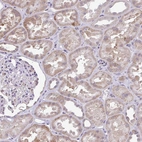 Immunohistochemical staining of human kidney shows weak granular cytoplasmic positivity in cells in tubules.